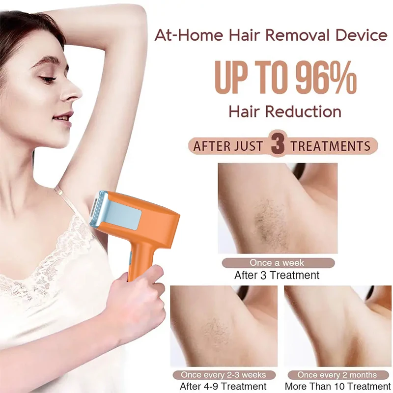 510K Home Use Handset hair Remover Machine  Painless Permanent At-Home Body Epilator Depilator Laser Light Hair Removal Device