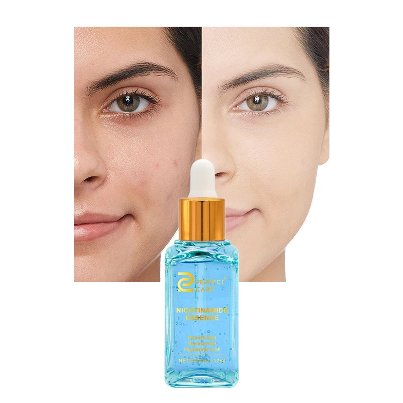 Oem Hyaluronic Acid Face Serum for Skin Care Improve Dark Spot Corrector Nourish Organic Nicotinamide Whitening Facial Serum