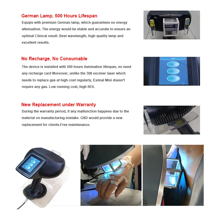 Led Popular 2023 For Oil Vitiligo Monobenzone Cream For Vitiligo Heshun Treatment 308nm Uvb Eximer Laser Vitiligo Psoriasis