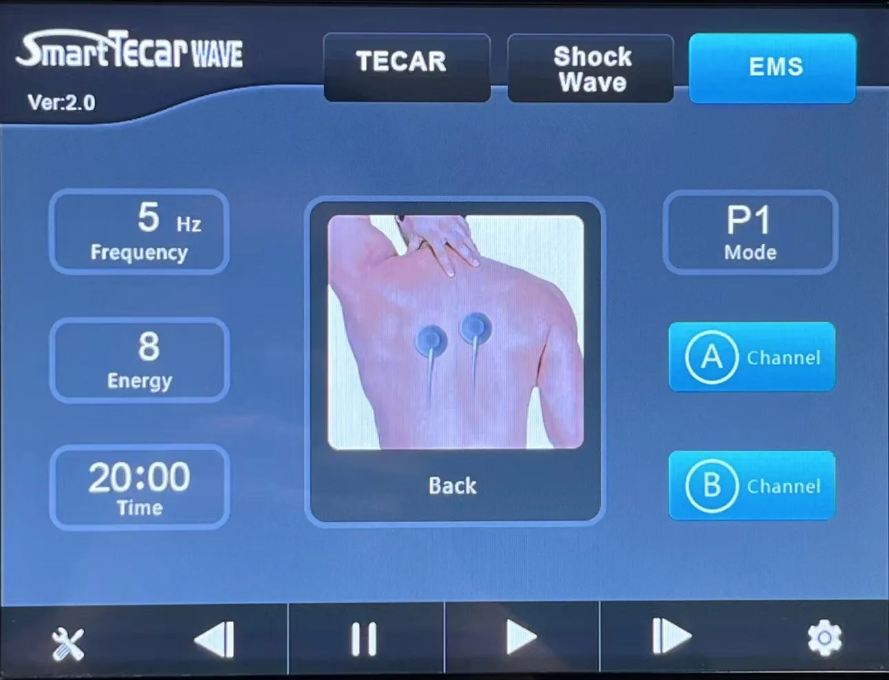 Multifunctional Smart Tecar Wave Shockwave Therapy For erectile Dysfunction Tecar Machine