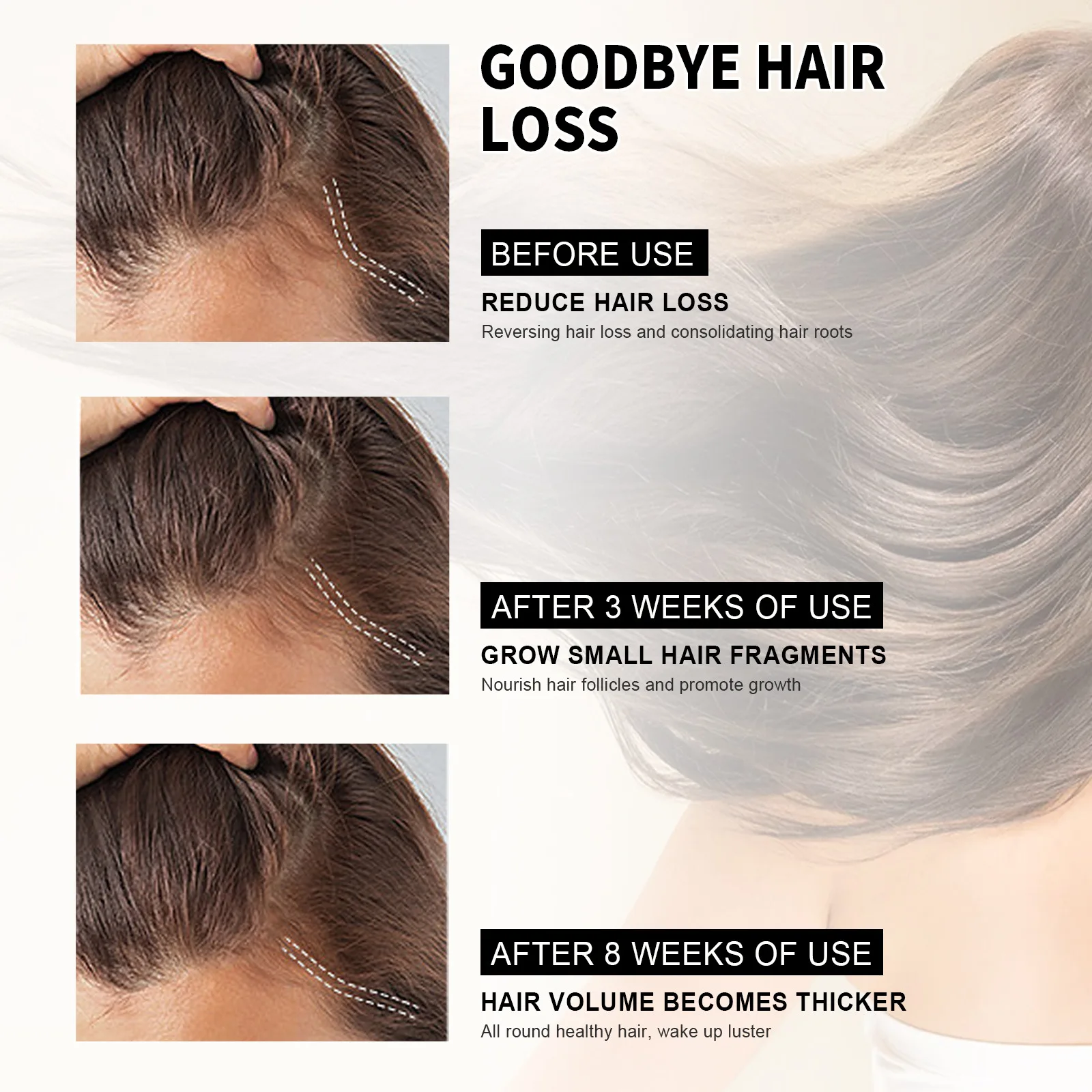 Wholesale 30ml/60ml Hair Growth Essential Oil For Hair Loss Treatment Regrowth Serum