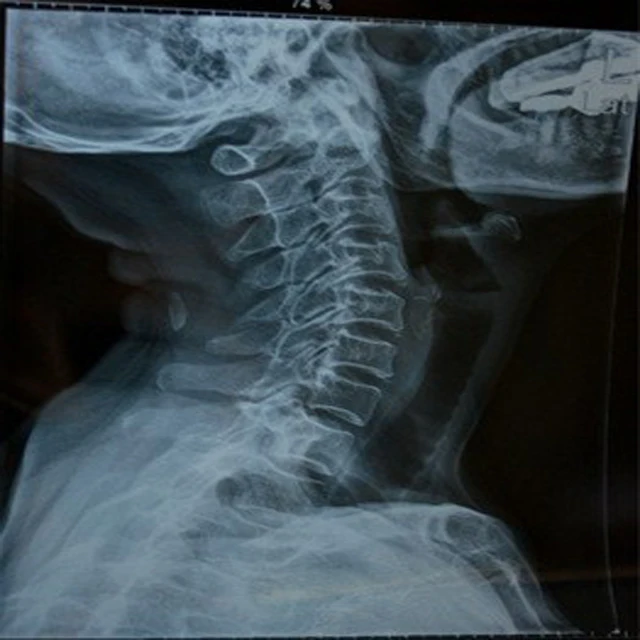 14x17 kenid x ray film / fuji film x ray di hl 14x17