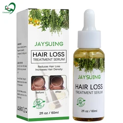 private label Rosemary Hair Growth oil product for black women scalp essential serum organic rose mary treatment for wild bald