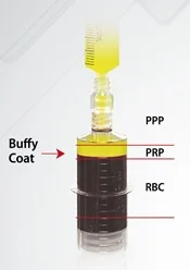  Корейская центрифуга prp