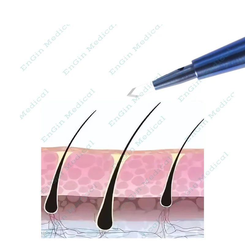 Premium Hair Transplant Sapphire Blades for Professional Use Sapphire Surgical Blades for Advanced Hair Transplant Techniques
