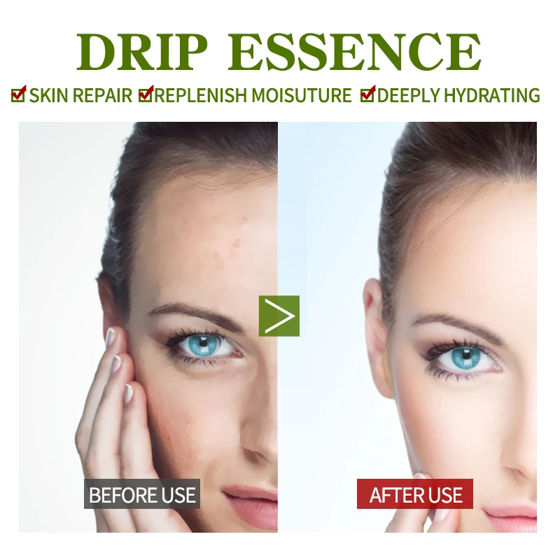 Wholesale Hyaluronic Acid Skin Repair Facial Serum Aloe Soothe Pores Shrink Firming Hydrating Vitamin B5 Face Serum