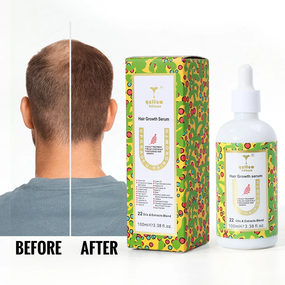 Custom private label best biotin hair vitamin growth serum oil organic rosemary  hair growth serum