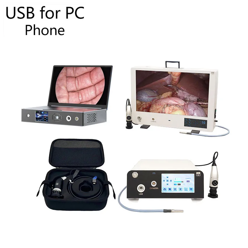HD 1080P Портативная эндоскопическая камера для спинномозговой хирургии гинекологии и урологии