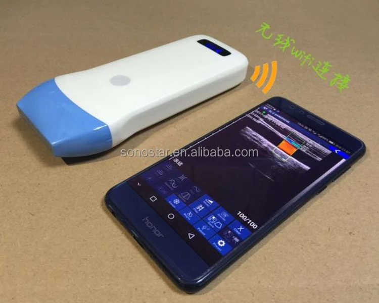 Ultrasonic, Optical, Electronic Equipment Manufacturer supply wireless probe ultrasound for mobile phone and tabletOther Ultras