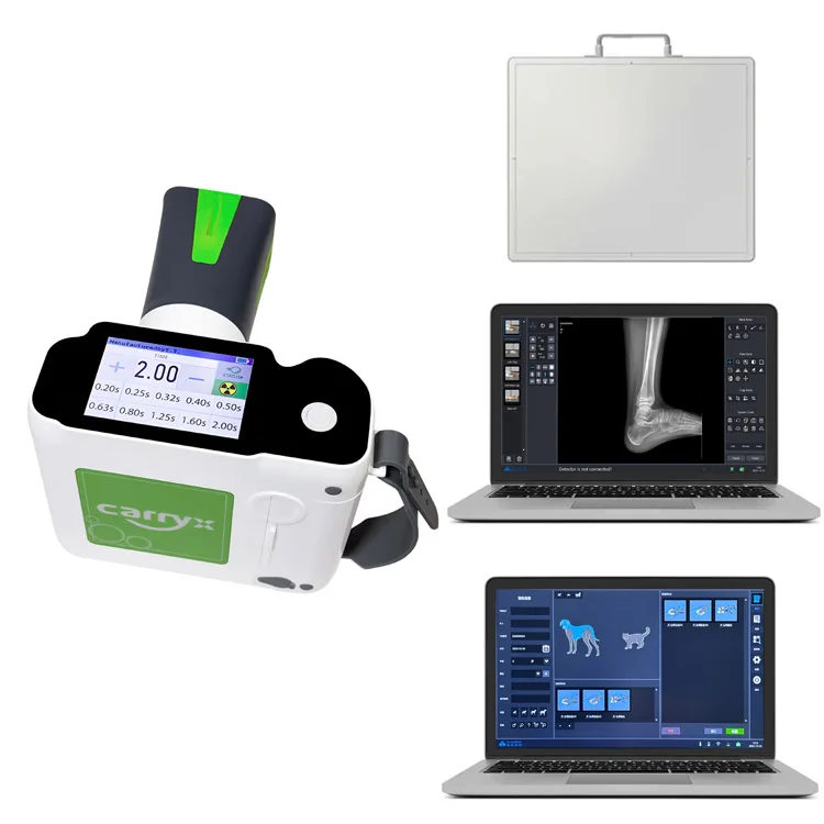 80Kv Professional Medical Portable DR X-Ray Machine/Veterinary Chest Portable X-ray Unit Machine For Body