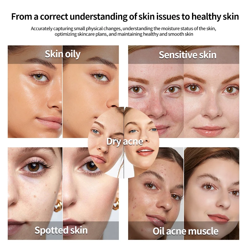 Portable Household Facial Skin Detection Meter Smart Sensor Beauty Device Customizable Skin Hydration Oil Analyzer