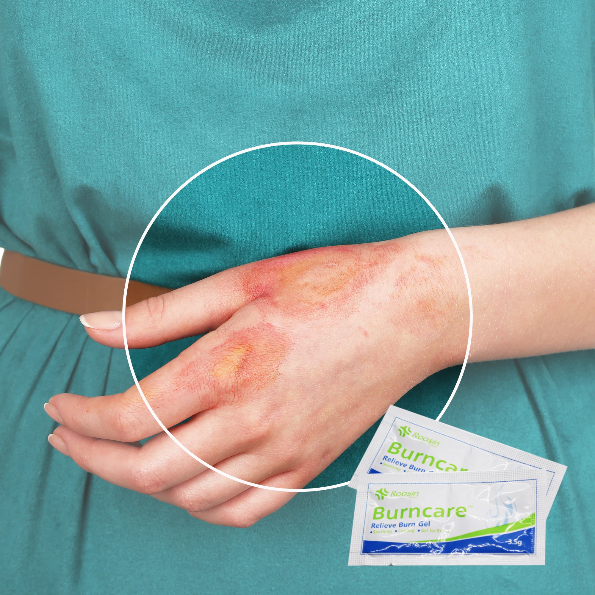Hydrogel Sterile Burn Pads Wound Dressing for Burn Relief
