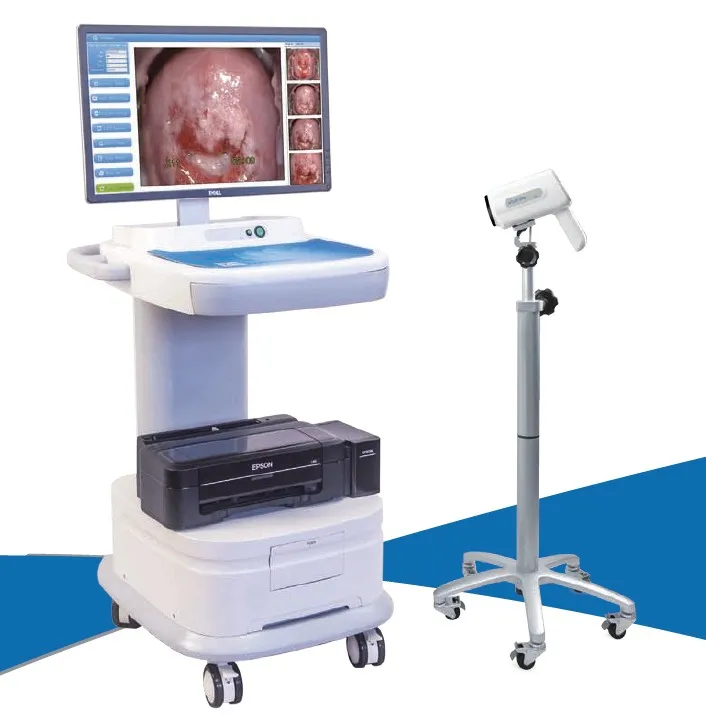 Advanced GHC8000 Medical 1080P HD Electronic Digital Gynecological Video Colposcope Image System With Luxurious style camera