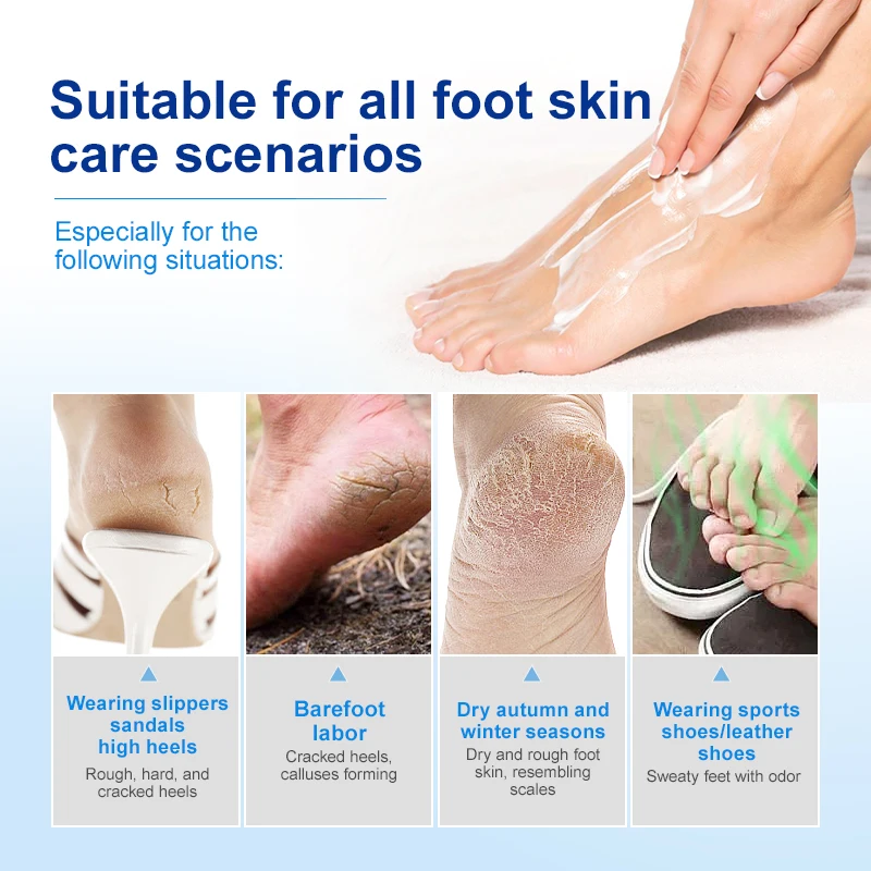 Hot selling 40% urea foot cream organic Deep Moisturizing Cracked Heel Treatment Dead Skin Removal Peeling foot cream