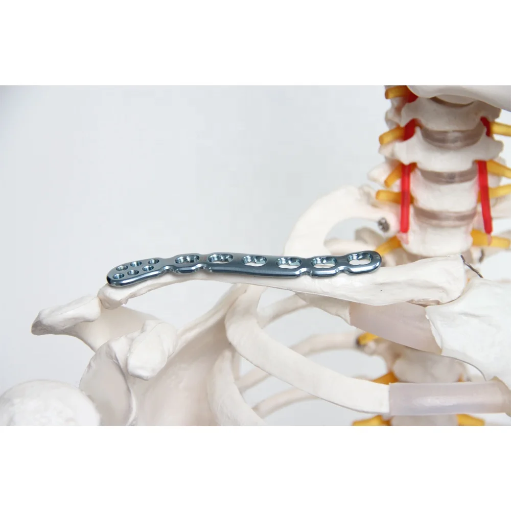 surgical Distal clavicle reconstruction  titanium locking Plate