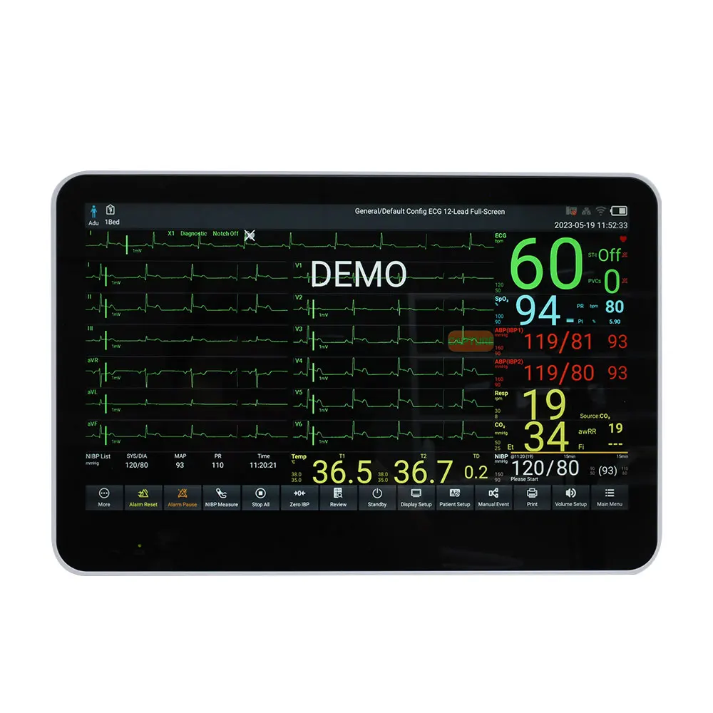 CONTEC CMS8500 ультратонкий портативный удаленный монитор пациента умный сенсорный экран