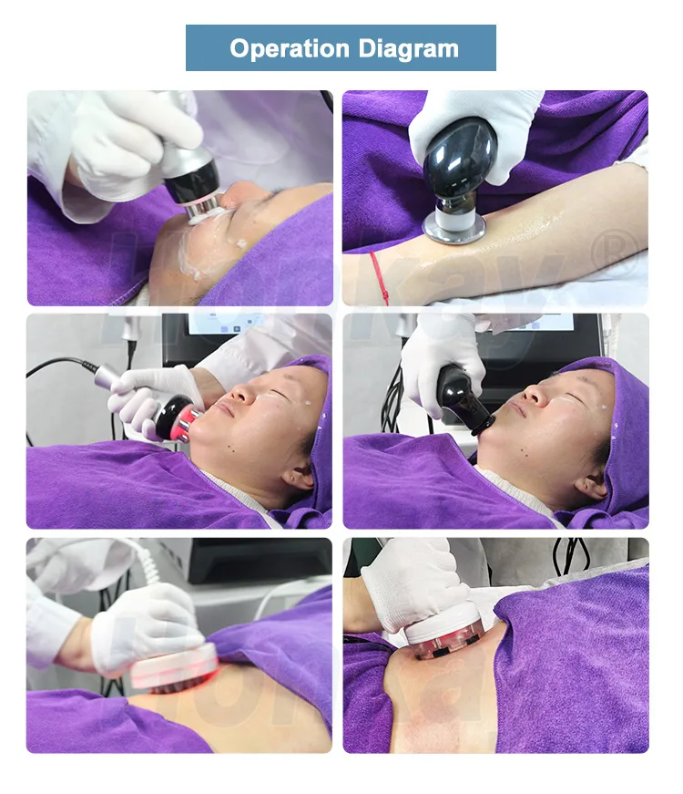 Portable pain relief tecartherapie radiofrequency physical rehabilitation tecar therapy physiotherapy machine