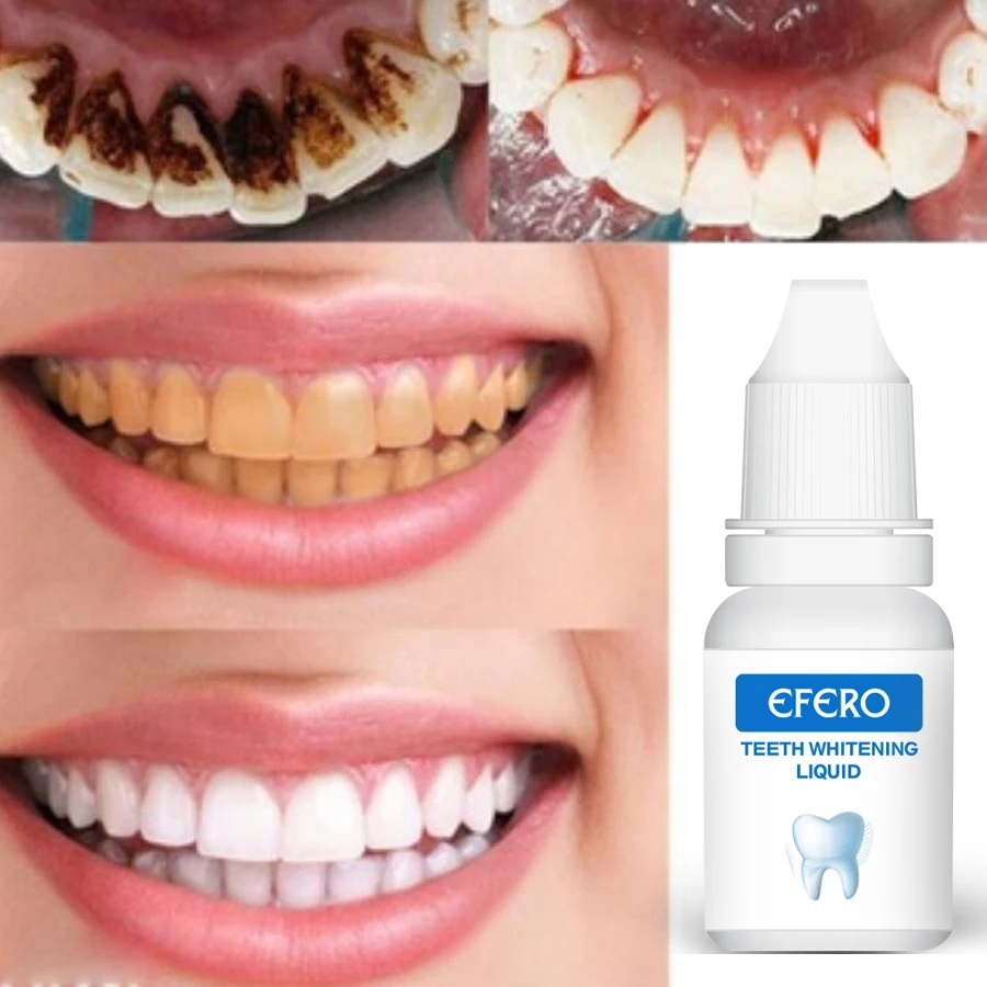 EFERO Teeth Whitening Powder Set Oral Whitening Essence Whitening Plaque Cleaning 10ml wholesale own brand