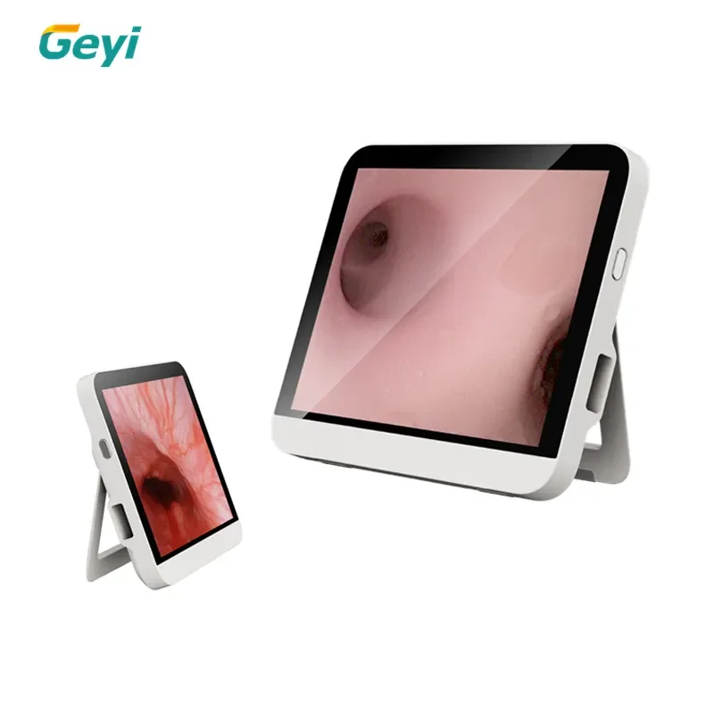 Geyi Disposable Digital Portable Flexible Veterinary Endoscope Bronchoscope Single Use