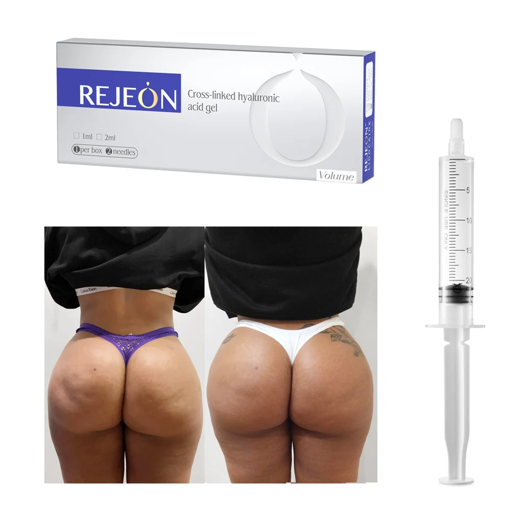 Hot sales REJEON hyaluronic acid butt filler for buttocks injection poly-l-lactic acid butt dermal filler  for butt enhancement