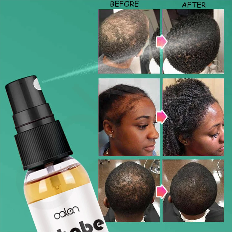 OALEN 120ML OEM Nourishing Hair Spray Thinning Moisturizing Keep Crimp Chebe Hair Growth Spray Oil Hair