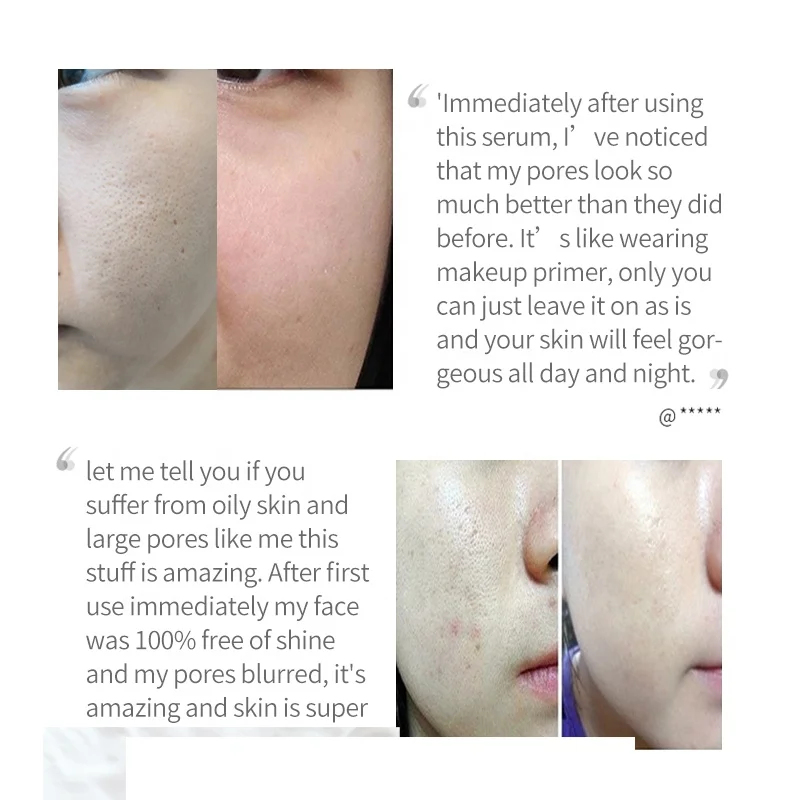 SAUVASINE  pore minimizer serum for shrinking unclogs enlarged pore anti ance serum