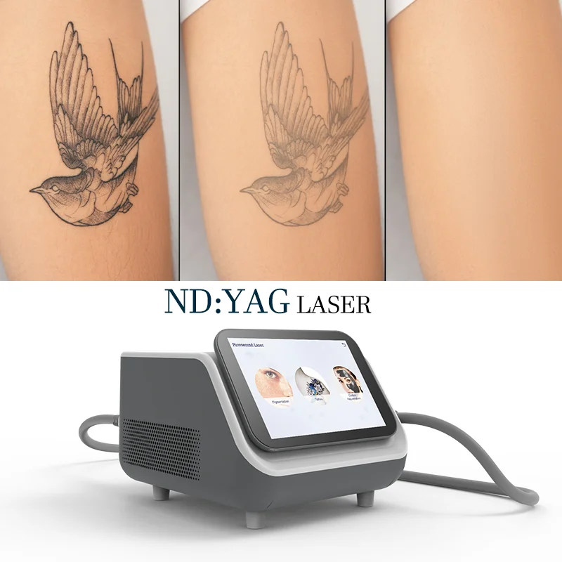q switched pico second portable laser tattoo removal handle nd yag q switched laser