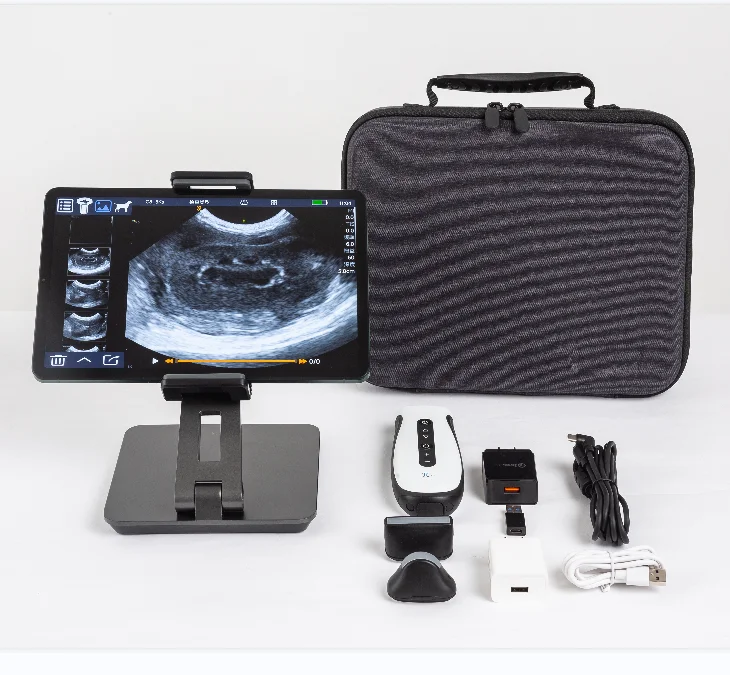 Ultrasound handheld 4d color doppler ultrasound echographe ultrasound scanner