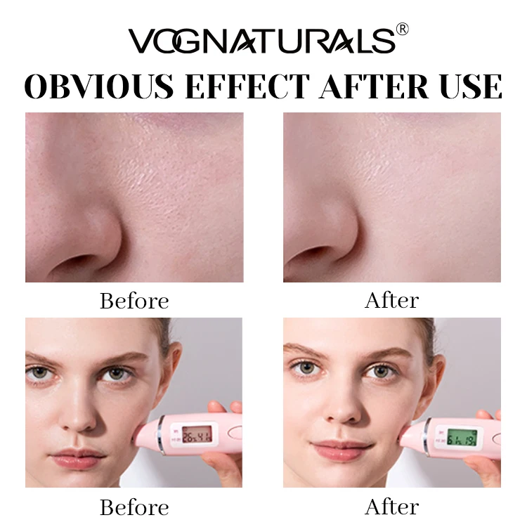 Private Label OEM Daily Skincare with Rice Whitening Face Care Set