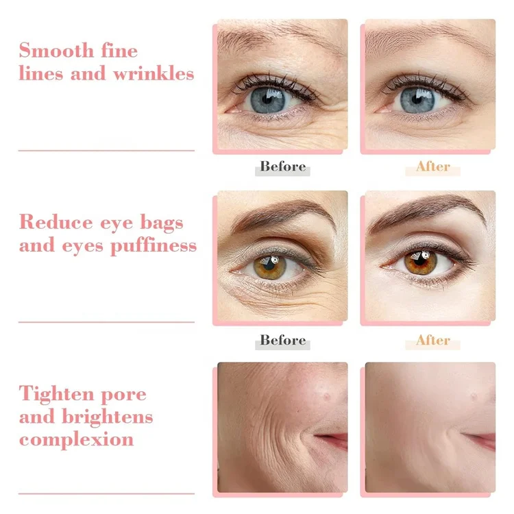 Home Beauty Facial Ice Roller Cooling Globe Set Cryo Massage Ball gold Stainless Steel Mini Facials Ice Globes For Face