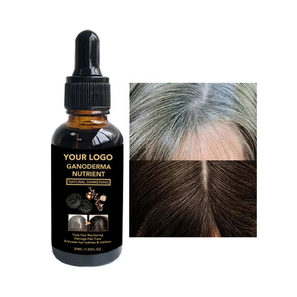 Thickening Natural Hair Growth Oil Private Label Hair Growth Oil Private Label White To Black Hair Oil