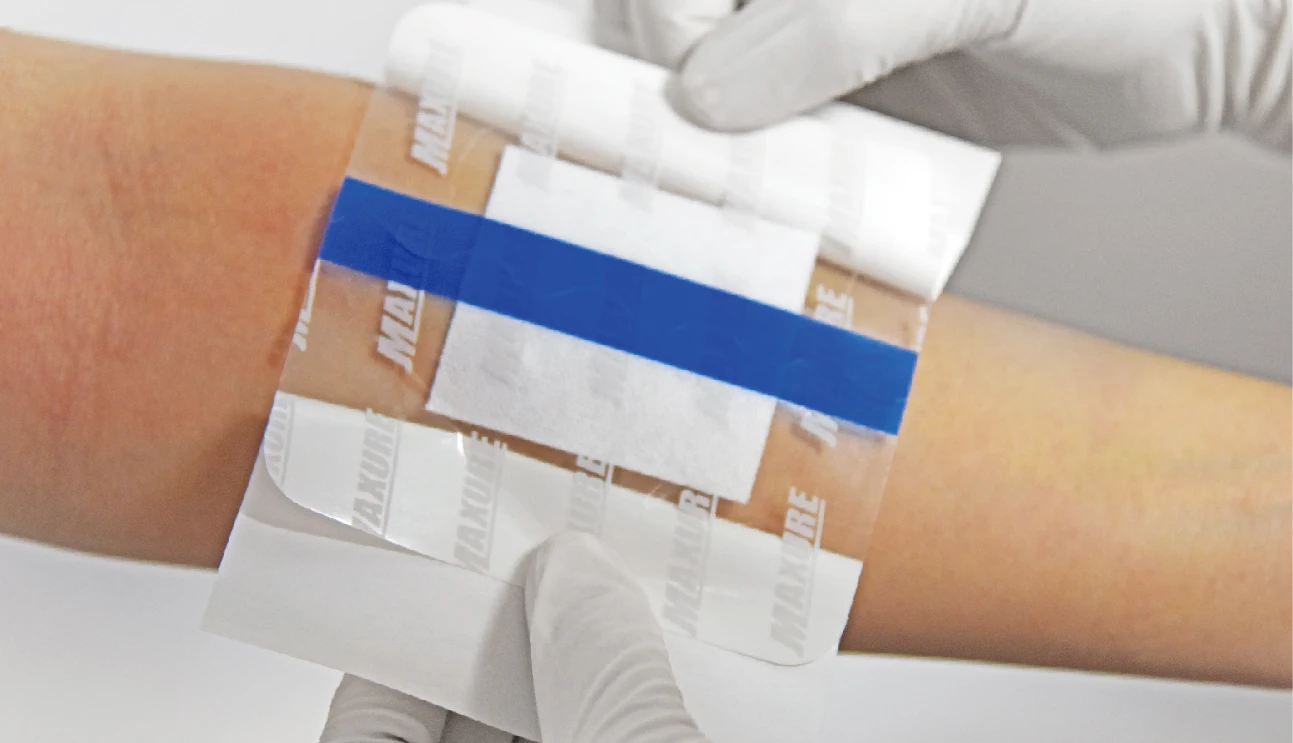 Waterproof Transparent Wound Dressing for Wound Healing