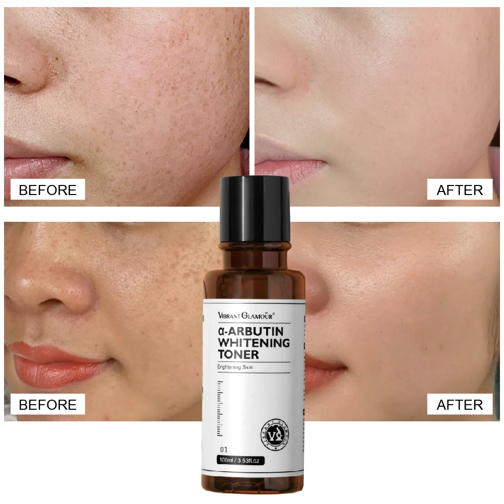 VIBRANT GLAMOUR Brighten Moisturizing Reduce Dullness Spot Acne Marks Facial Skin Care Arbutin Whitening Toner