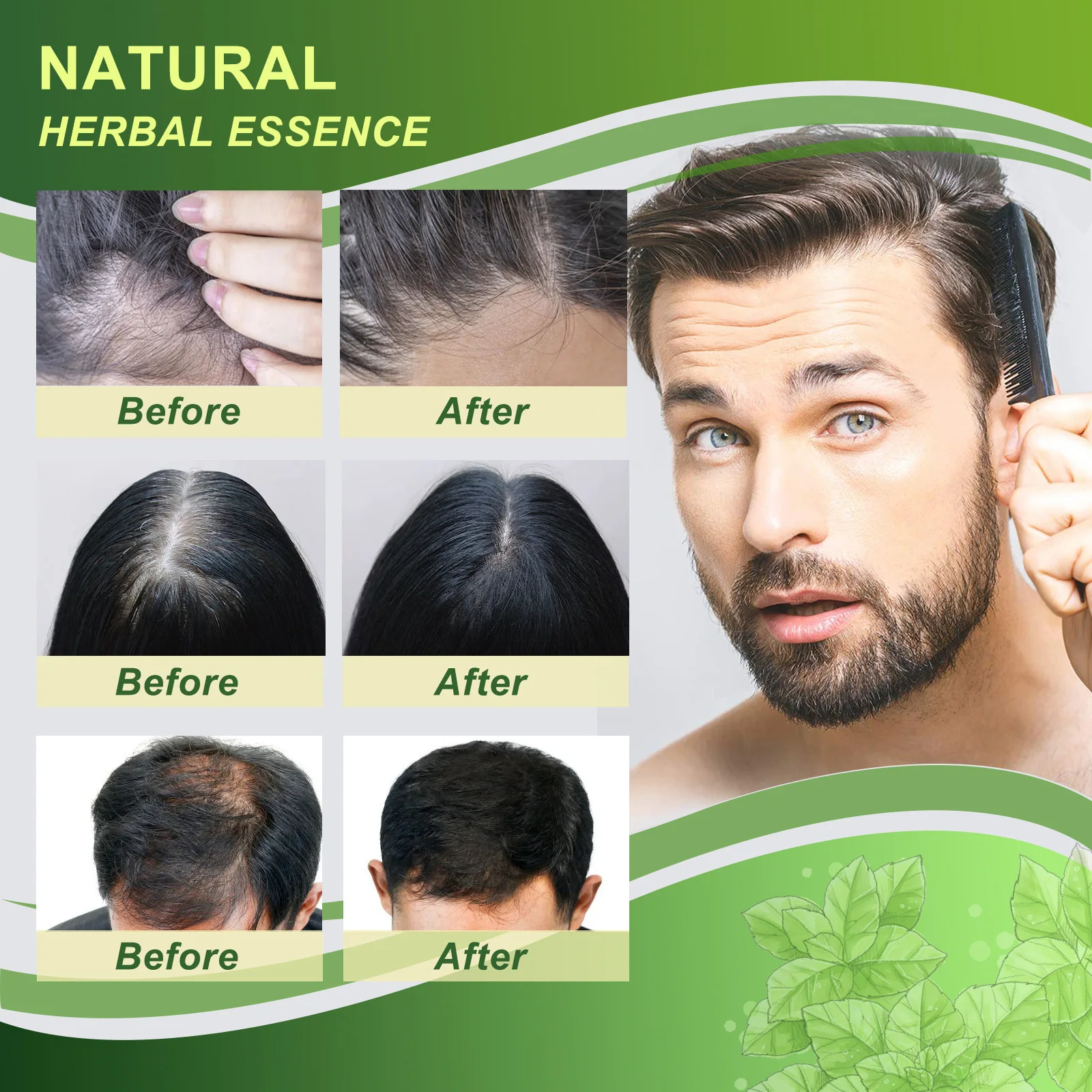 Regrowth Shampoo Moisturize Hair Root Anti Hair Loss Growth Hair Shampoo