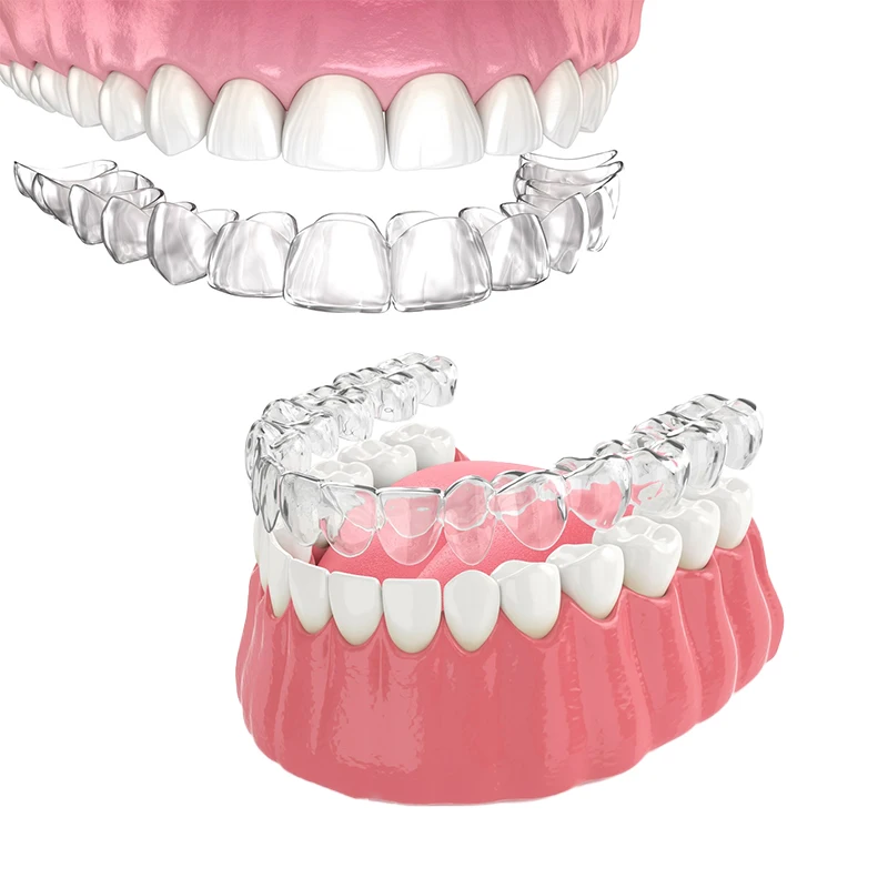 China Manufacturer Dental Straighten Your Teeth Invisalign Treatment Braces Aligners Clear Resin Coping Sheet Tpu&petg