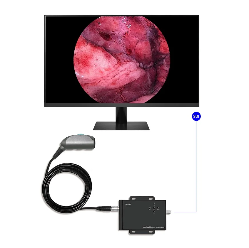 Более низкая цена 1080P HDMI ветеринарная медицинская эндоскопическая камера для животных переносная жесткого эндоскопа