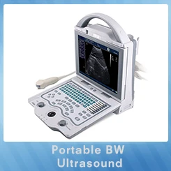 Portable BW Ultrasound.jpg