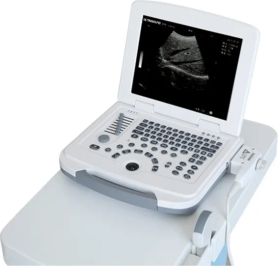 Портативный Ультразвуковой/ноутбук с большим экраном 12 дюймов диагностический ультразвуковой
