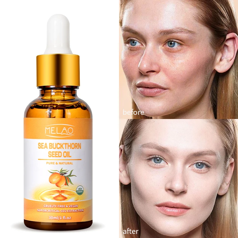 100% Pure Natural Organic Cold-Pressed Sea Buckthorn Seed Oil Brightening Anti Redness Sensitive Skin Care Moisturizing Face Oil
