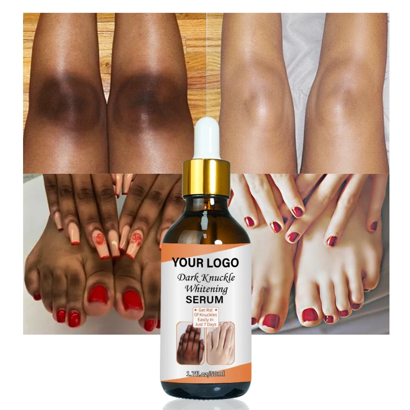 Фирменная Сыворотка для быстрого отбеливания суставов колена, сыворотка для удаления интенсивных пятен на коленях