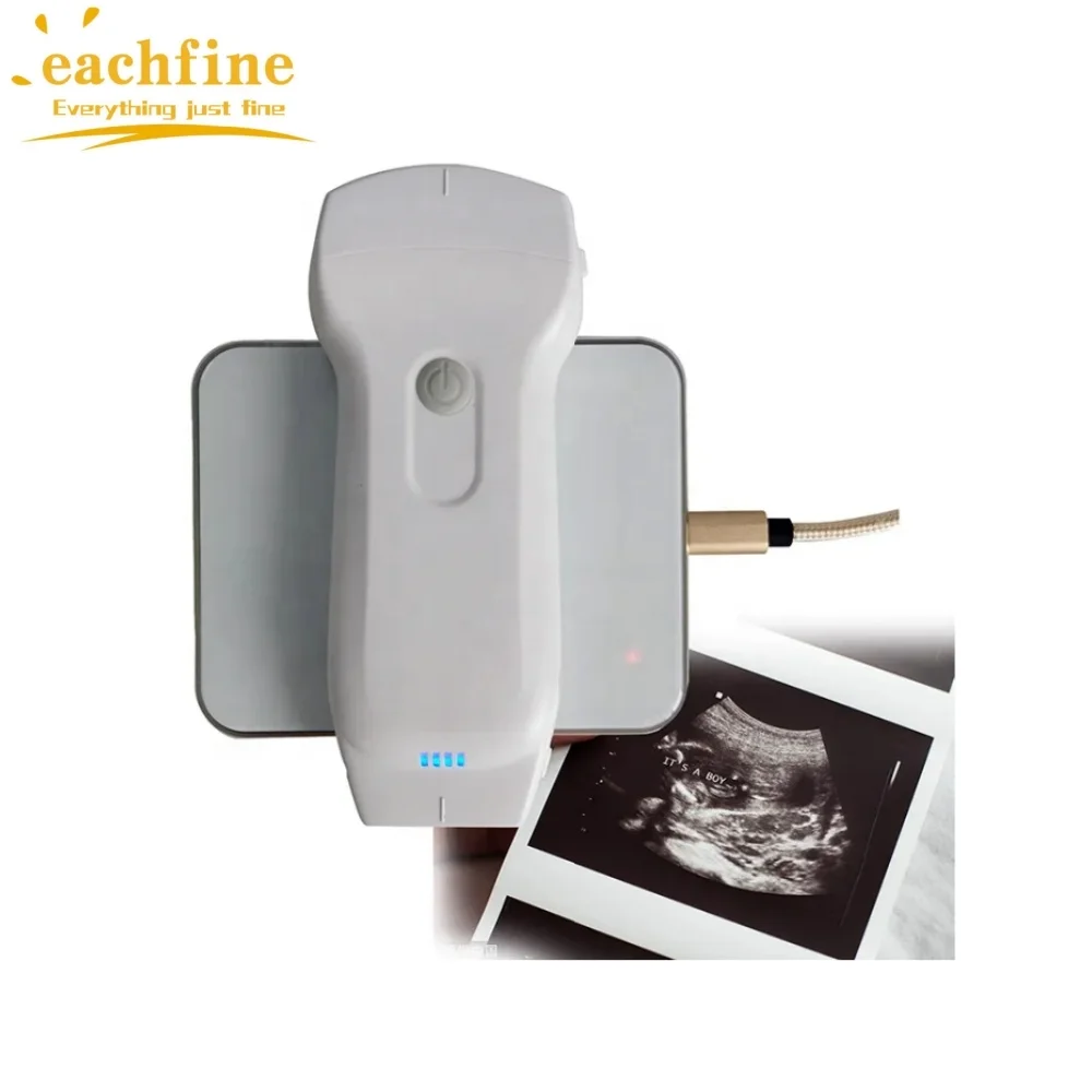 ultrasound machine 192 element human use portable wireless ultrasound scanner color doppler 2 probe 3 in 1 portable ultrasound