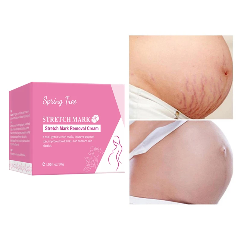 Private Label 100% Natural Vegan Anti Postpartum Deep Acne Scar Removal Stretch Mark Cream