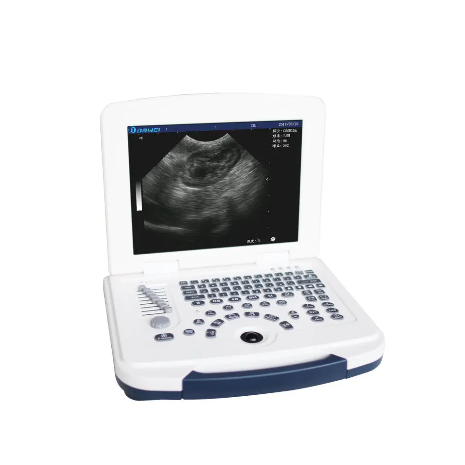 DW580 Medical Full digital Laptop Portable Ultrasound Machine Black and White Ultrasound