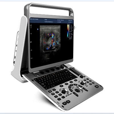 Chison 4D Digital Color Doppler Ebit 30 for medical portable ultrasound scanner machine laptop