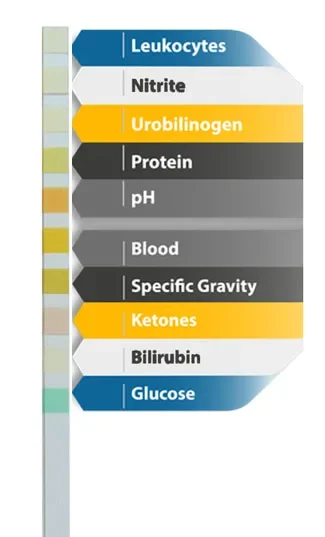 urine test strip URS-10T Urinalysis reagent strips OEM accept