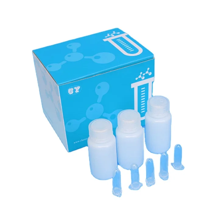 Custom high quality diagnostic reagents and kits rna reagent kit reagent kit