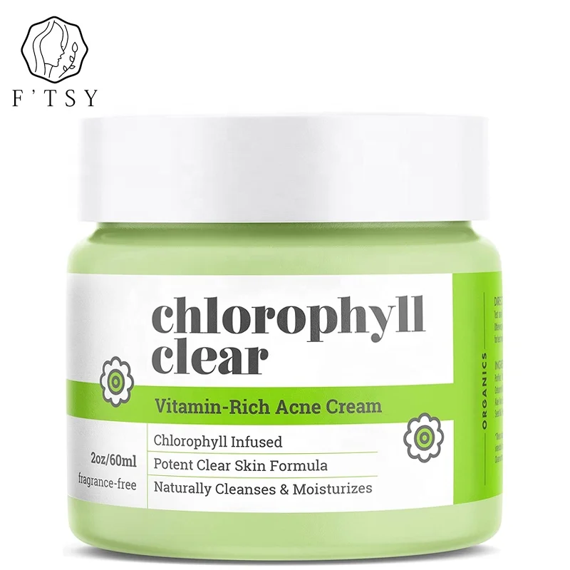 Noticeable Moisture Heal and Recover Blackheads Spot Treatment Tea Tree Oil Natural Cystic Pimple Acne Dark Spot Cream for Face