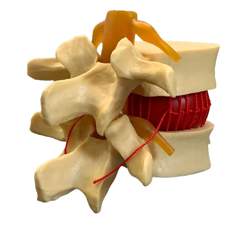 Disease vertebra skeleton joint model Plastic Lumbar disc herniation oppression display model