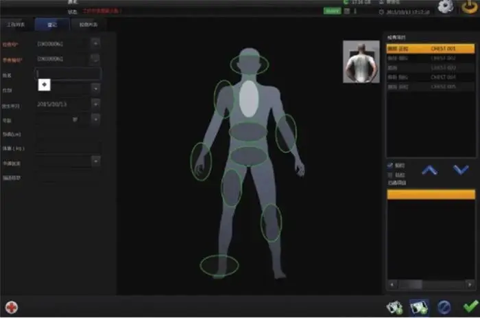 High quality 17x17in	Flat Panel Detector Digital Wireless X-Ray Machine DR RX Flat Panel Detector