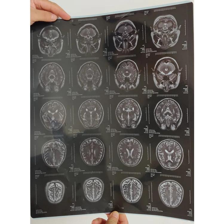 DT2B 10x12 inch medical xray film dry film for  AGFA Drystar  5302/5503 imager